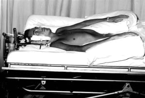 Patient in traction on a turning bed, which relieved pressure and changed position.